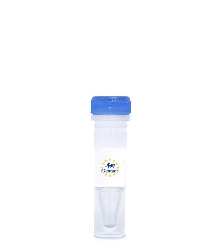 Avian Cholera Antibody (cholera) ELISA Kit